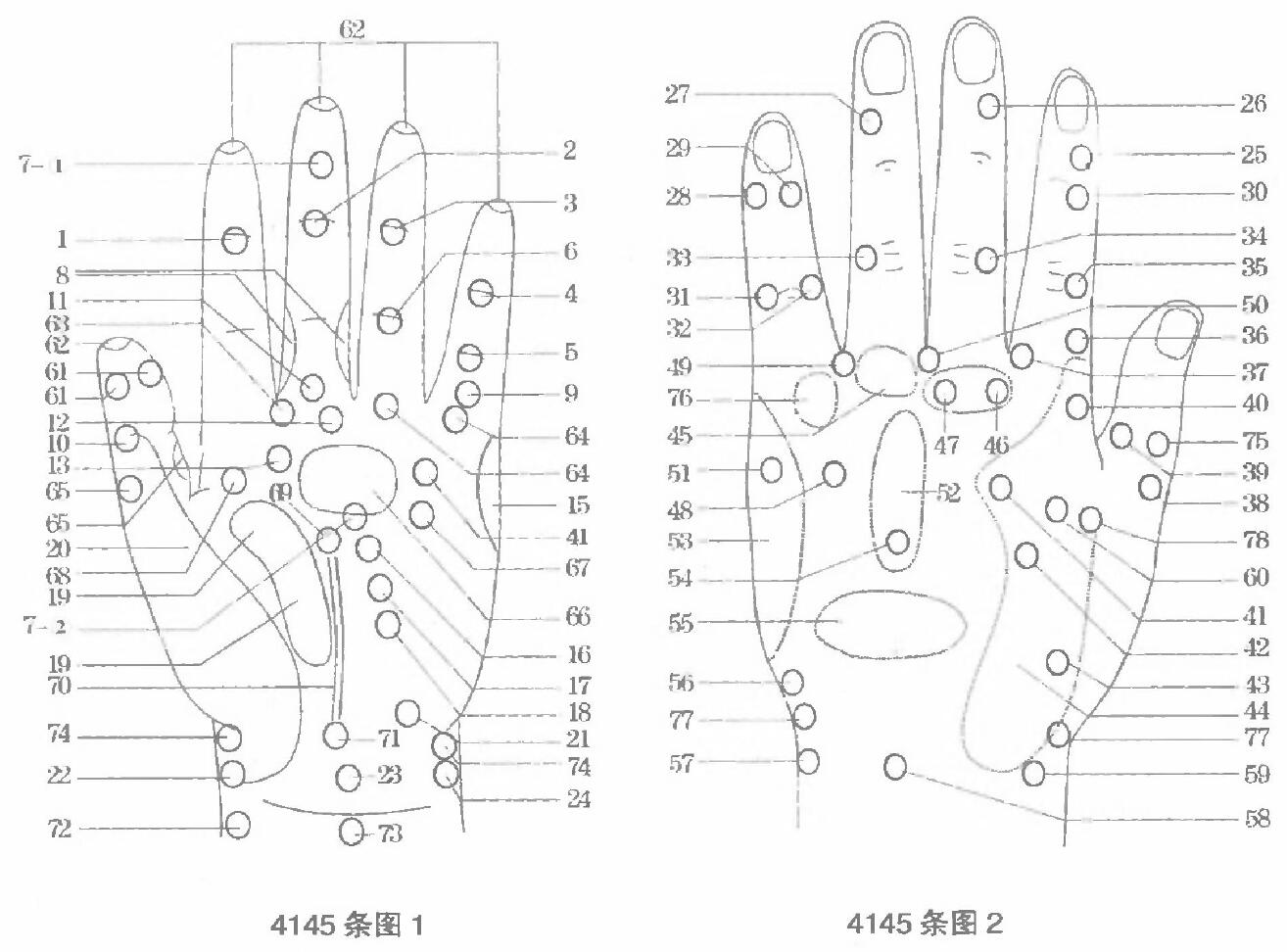 手部病理反射点.jpg