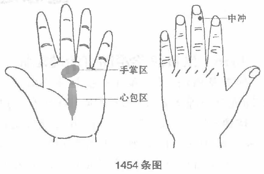 刺激手部二区一穴治失眠颇有功效.jpg